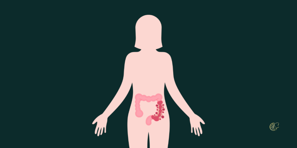 Εκκολπώματα και διατροφή