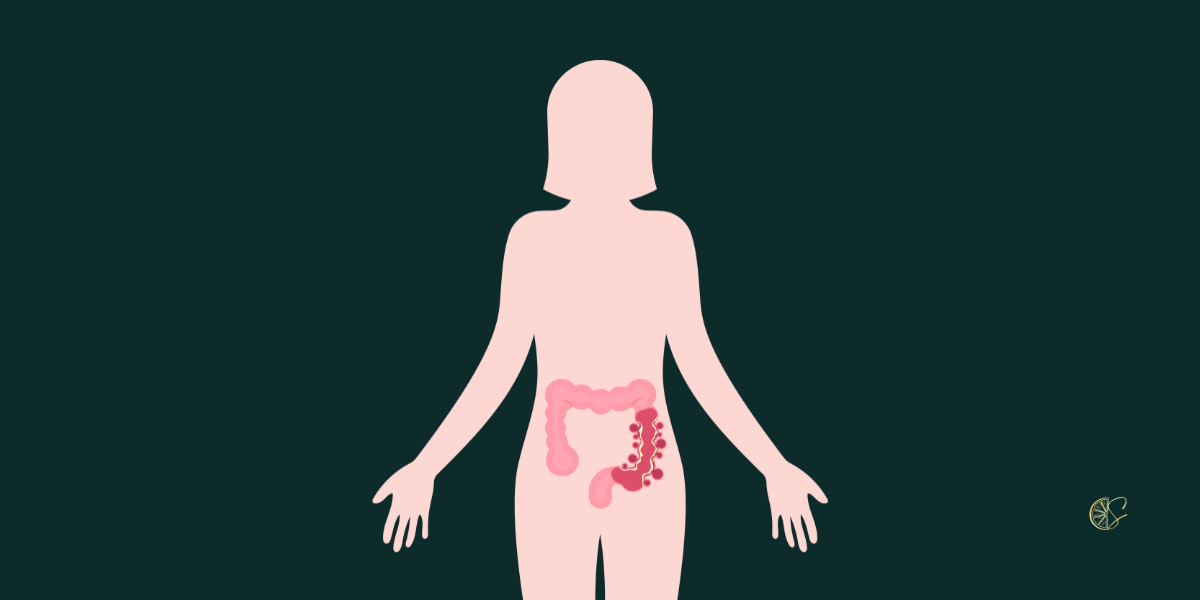 Εκκολπώματα και διατροφή